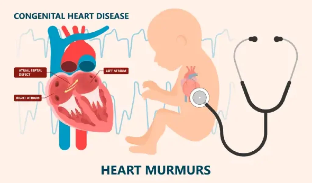 Congenital Heart Disease