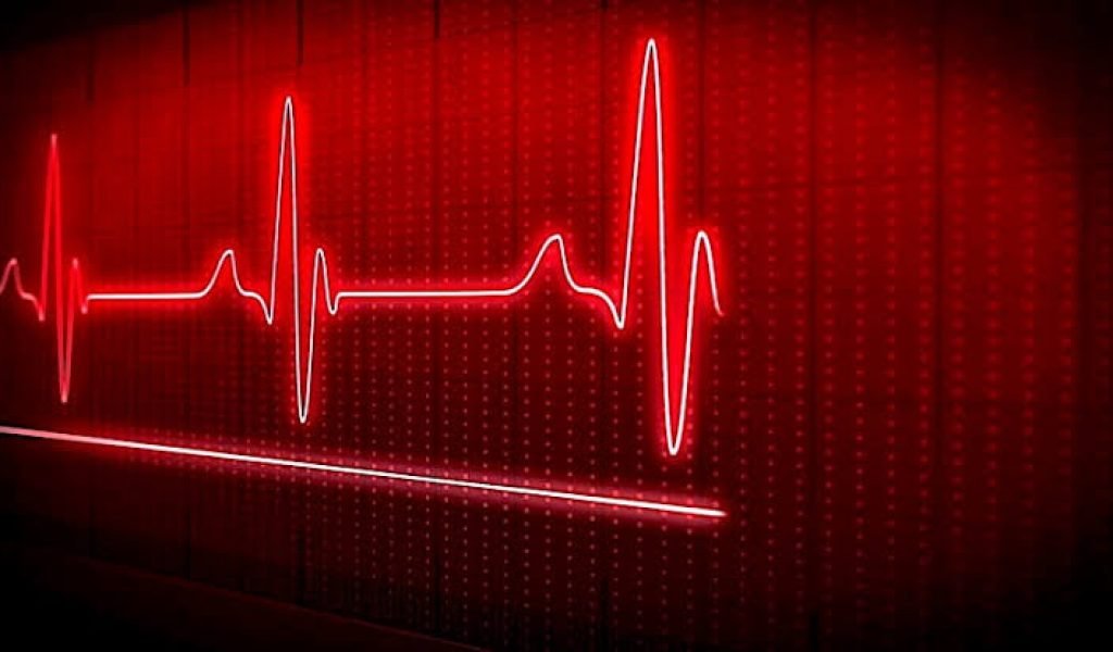 ECG