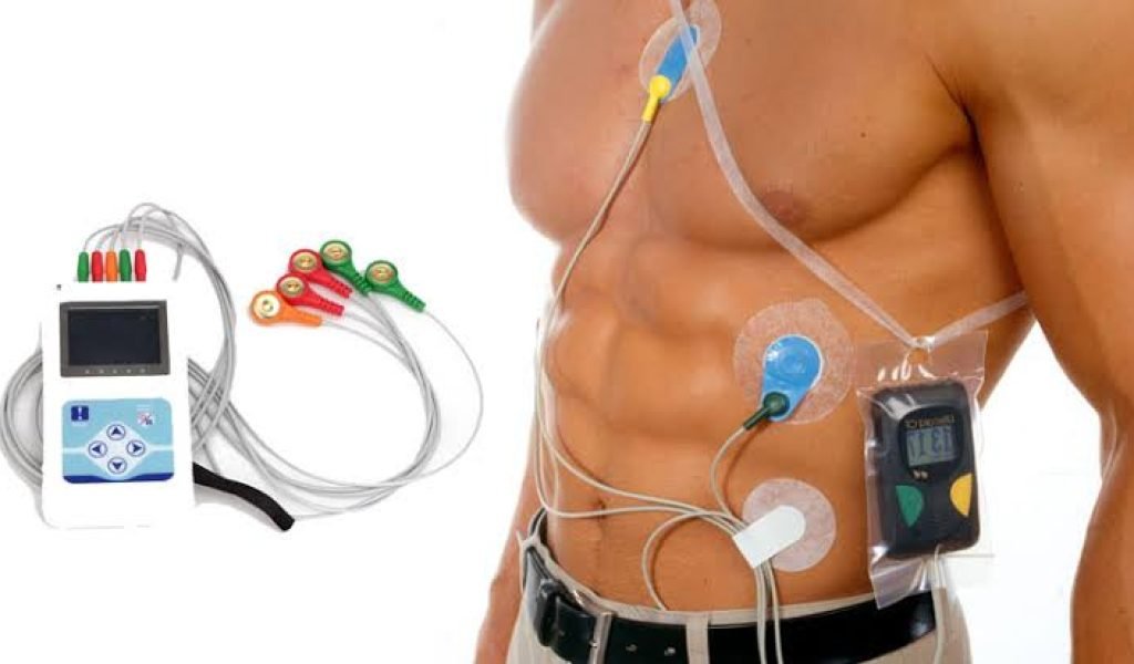 Holter Monitoring