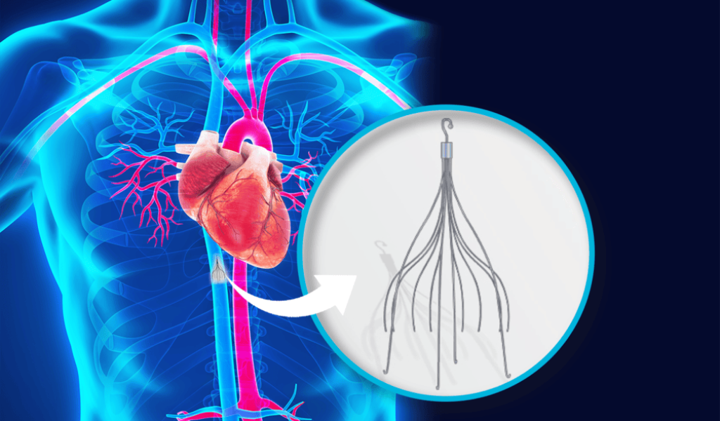 IVC Filter Placement