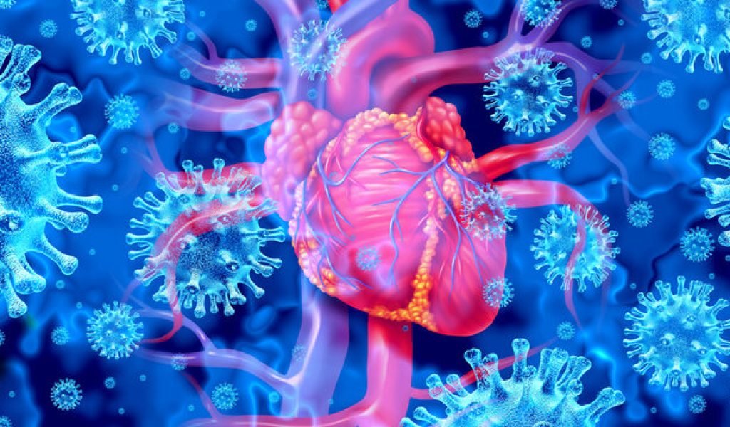 Myocarditis