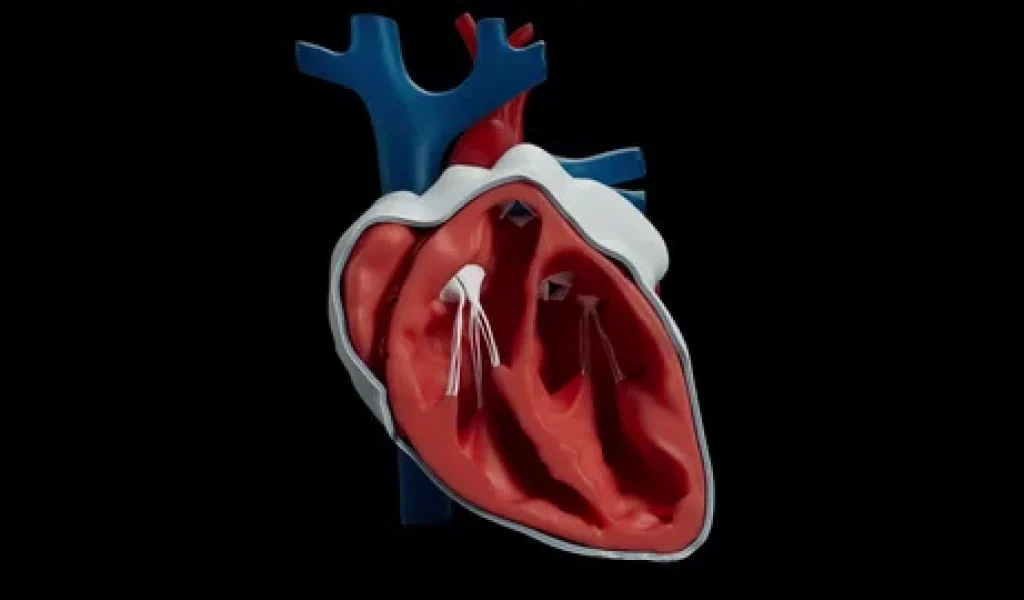 Pericarditis